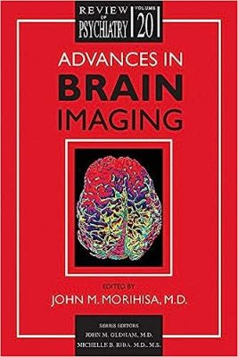 free-pdf-download-Advances in Brain Imaging (Review of Psychiatry) 1st Edition