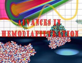 free-pdf-download-Advances in Hemodiafiltration