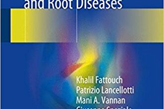 free-pdf-download-Advances in Treatments for Aortic Valve and Root Diseases 1st ed. 2018 Edition