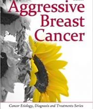 free-pdf-download-Aggressive Breast Cancer (Cancer Etiology