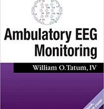 free-pdf-download-Ambulatory EEG Monitoring (2017 Release)