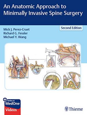 free-pdf-download-An Anatomic Approach to Minimally Invasive Spine Surgery 2nd Edition