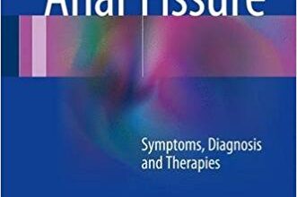 free-pdf-download-Anal Fissure: Symptoms