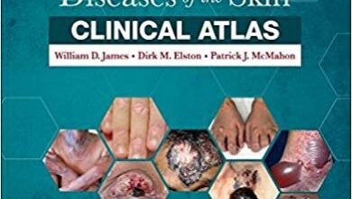 free-pdf-download-Andrews’ Diseases of the Skin Clinical Atlas