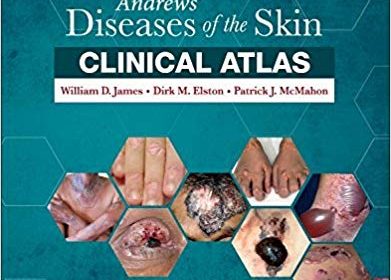 free-pdf-download-Andrews’ Diseases of the Skin Clinical Atlas