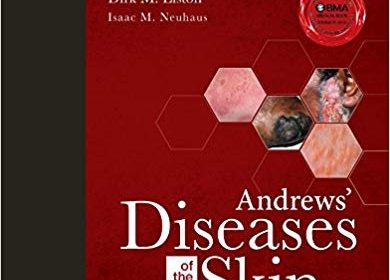 free-pdf-download-Andrews’ Diseases of the Skin: Clinical Dermatology