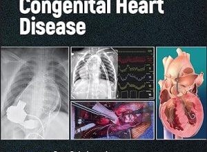 free-pdf-download-Anesthesia for Congenital Heart Disease 4th Edition