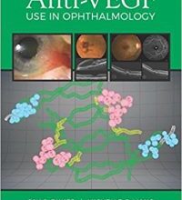 free-pdf-download-Anti-VEGF Use in Ophthalmology 1st Edition