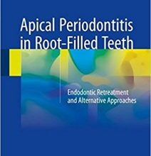 free-pdf-download-Apical Periodontitis in Root-Filled Teeth: Endodontic Retreatment and Alternative Approaches 1st ed. 2018 Edition