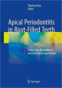 free-pdf-download-Apical Periodontitis in Root-Filled Teeth: Endodontic Retreatment and Alternative Approaches 1st ed. 2018 Edition