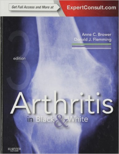 free-pdf-download-Arthritis in Black and White: Expert Consult – Online and Print