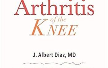 free-pdf-download-Arthritis of the Knee