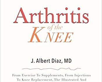 free-pdf-download-Arthritis of the Knee