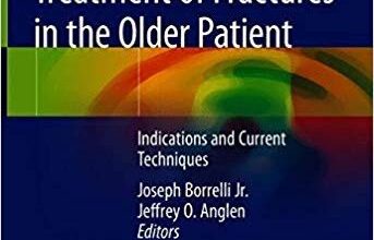 free-pdf-download-Arthroplasty for the Treatment of Fractures in the Older Patient: Indications and Current Techniques 1st ed. 2018 Edition