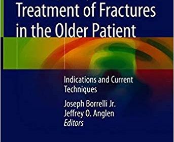 free-pdf-download-Arthroplasty for the Treatment of Fractures in the Older Patient: Indications and Current Techniques 1st ed. 2018 Edition