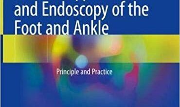 free-pdf-download-Arthroscopy and Endoscopy of the Foot and Ankle: Principle and Practice 1st ed