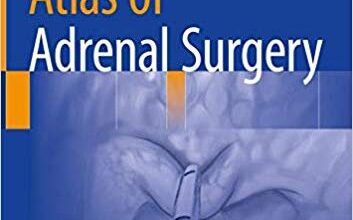 free-pdf-download-Atlas of Adrenal Surgery 1st ed