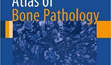 free-pdf-download-Atlas of Bone Pathology (Atlas of Anatomic Pathology)