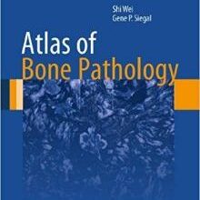 free-pdf-download-Atlas of Bone Pathology (Atlas of Anatomic Pathology)