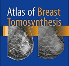 free-pdf-download-Atlas of Breast Tomosynthesis: Imaging Findings and Image-Guided Interventions 1st ed