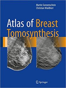 free-pdf-download-Atlas of Breast Tomosynthesis: Imaging Findings and Image-Guided Interventions 1st ed. 2017 Edition