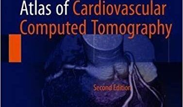 free-pdf-download-Atlas of Cardiovascular Computed Tomography 2nd ed