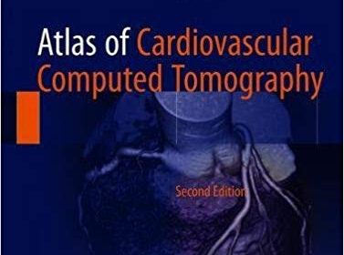 free-pdf-download-Atlas of Cardiovascular Computed Tomography 2nd ed