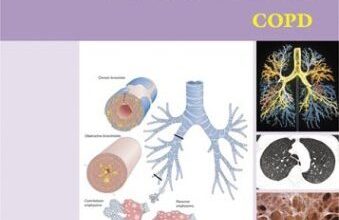 free-pdf-download-Atlas of Chronic Obstructive Pulmonary Disease