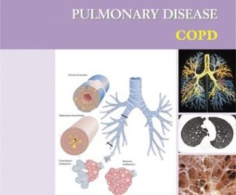 free-pdf-download-Atlas of Chronic Obstructive Pulmonary Disease