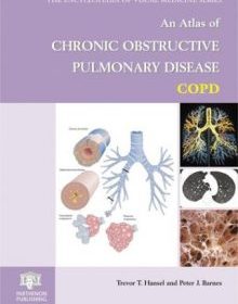 free-pdf-download-Atlas of Chronic Obstructive Pulmonary Disease