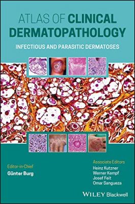 free-pdf-download-Atlas of Clinical Dermatopathology: Infectious and Parasitic Dermatoses