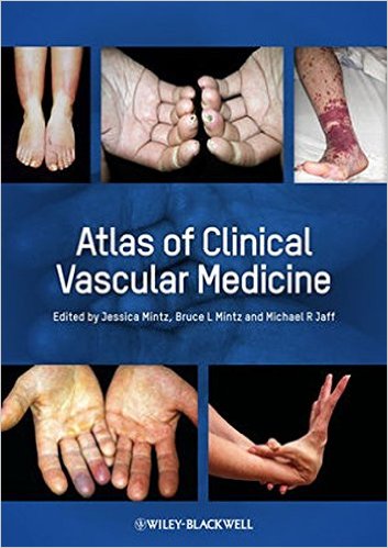 free-pdf-download-Atlas of Clinical Vascular Medicine 1st Edition