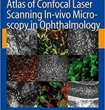 free-pdf-download-Atlas of Confocal Laser Scanning In-vivo Microscopy in Ophthalmology 2006th Edition