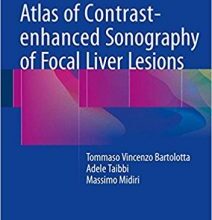 free-pdf-download-Atlas of Contrast-enhanced Sonography of Focal Liver Lesions