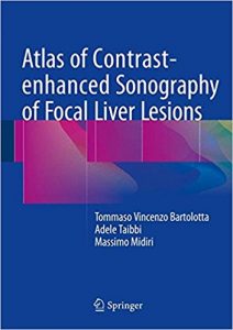 free-pdf-download-Atlas of Contrast-enhanced Sonography of Focal Liver Lesions