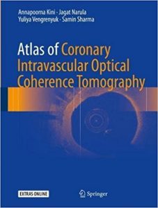 free-pdf-download-Atlas of Coronary Intravascular Optical Coherence Tomography 1st ed. 2018 Edition