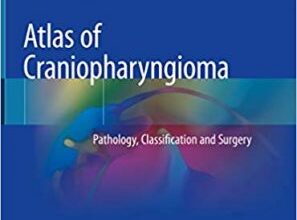 free-pdf-download-Atlas of Craniopharyngioma: Pathology