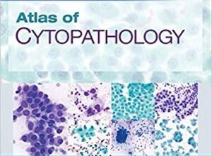 free-pdf-download-Atlas of Cytopathology: A Pattern Based Approach