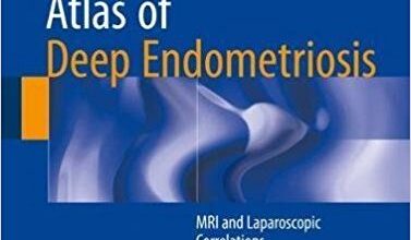 free-pdf-download-Atlas of Deep Endometriosis: MRI and Laparoscopic Correlations 1st ed