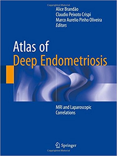 free-pdf-download-Atlas of Deep Endometriosis: MRI and Laparoscopic Correlations 1st ed. 2018 Edition