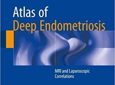 free-pdf-download-Atlas of Deep Endometriosis: MRI and Laparoscopic Correlations 1st ed