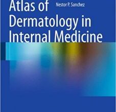 free-pdf-download-Atlas of Dermatology in Internal Medicine