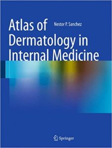 free-pdf-download-Atlas of Dermatology in Internal Medicine