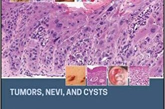 free-pdf-download-Atlas of Dermatopathology: Tumors