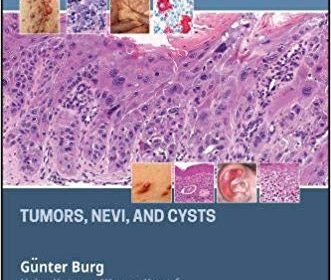 free-pdf-download-Atlas of Dermatopathology: Tumors