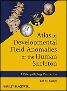 free-pdf-download-Atlas of Developmental Field Anomalies of the Human Skeleton: A Paleopathology Perspective 1st Edition