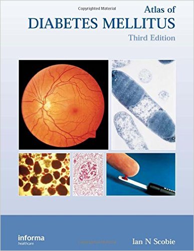 free-pdf-download-Atlas of Diabetes Mellitus