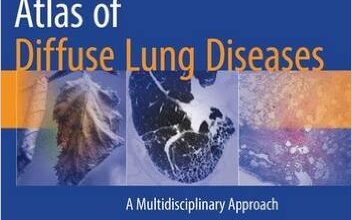 free-pdf-download-Atlas of Diffuse Lung Diseases: A Multidisciplinary Approach 1st ed. 2017 Edition