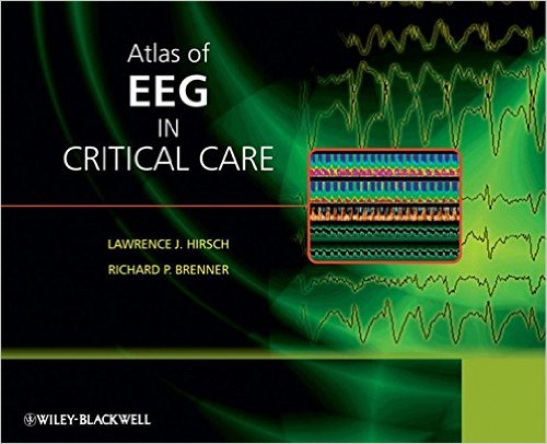 free-pdf-download-Atlas of EEG in Critical Care 1st Edition