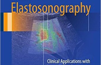 free-pdf-download-Atlas of Elastosonography: Clinical Applications with Imaging Correlations 1st ed. 2017 Edition